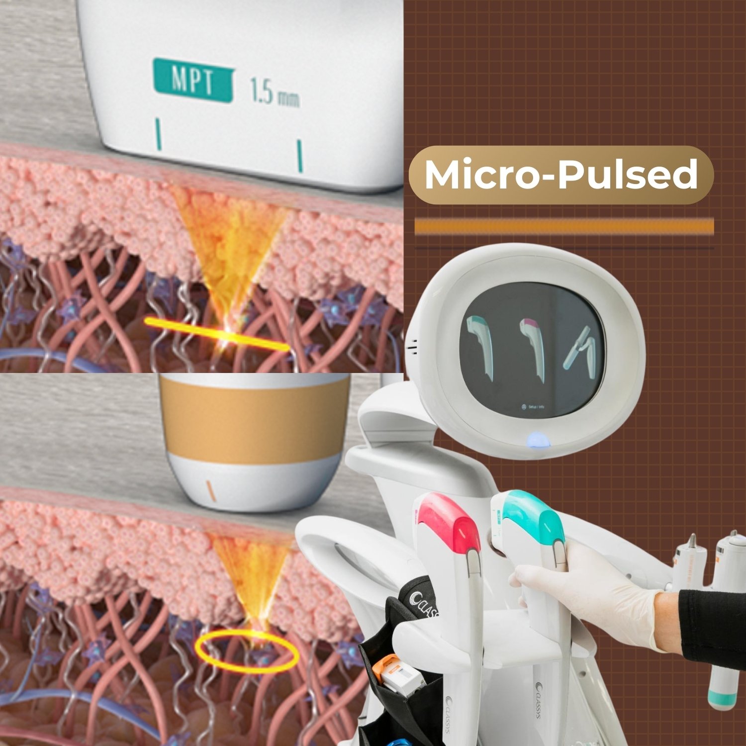 Micro Pulsed