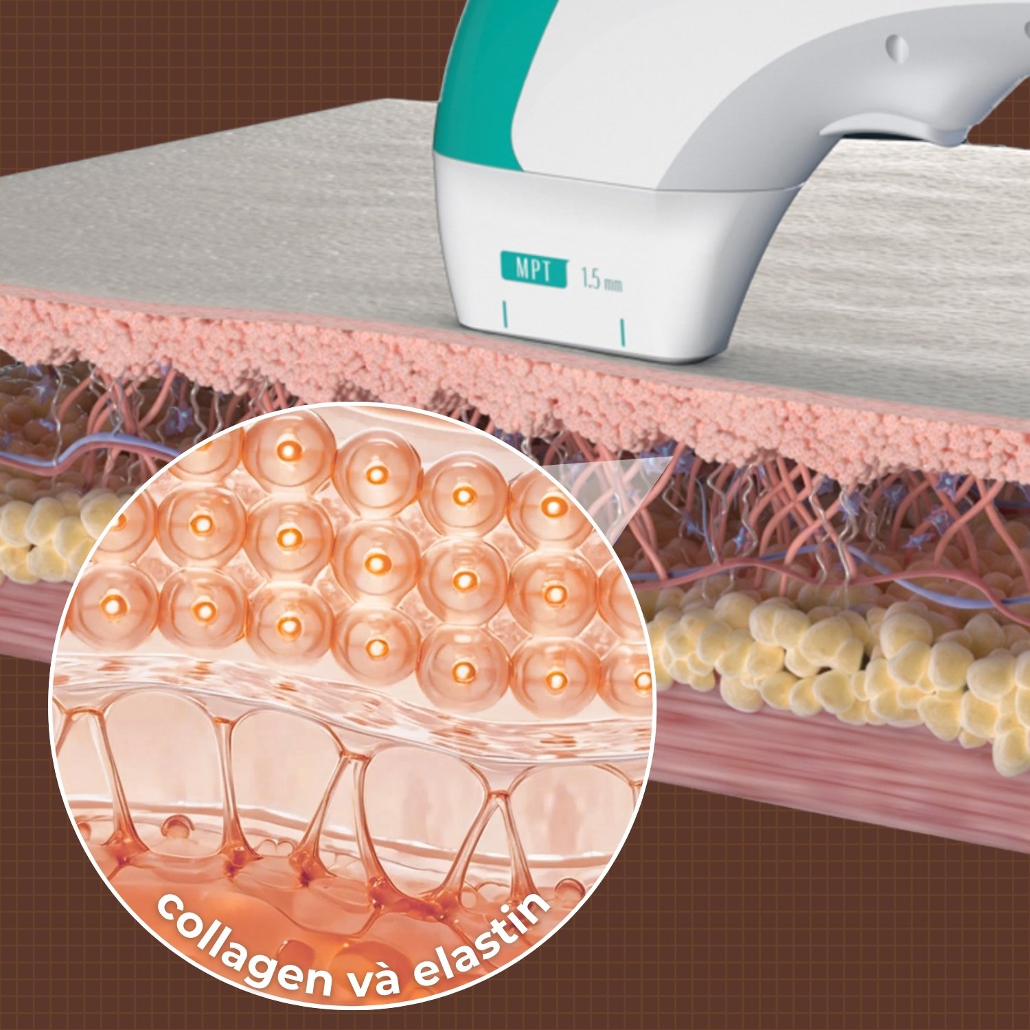 Tăng sinh collagen và elastin