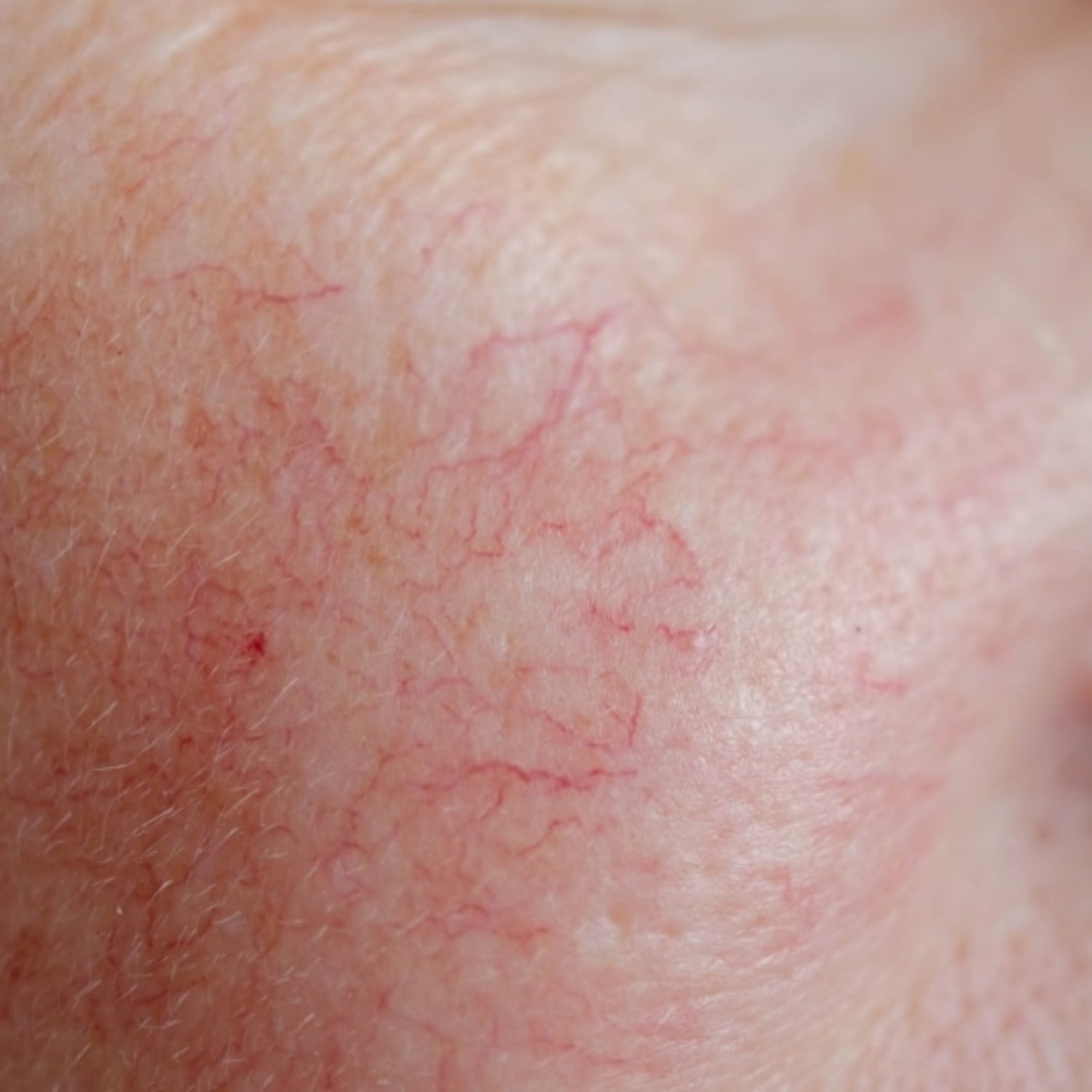 Vấn đề da khác