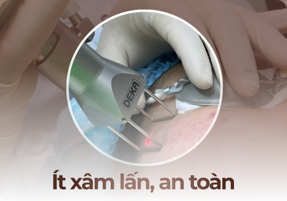 Ít xâm lấn - An toàn