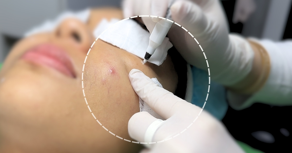 Ít xâm lấn, hồi phục nhanh