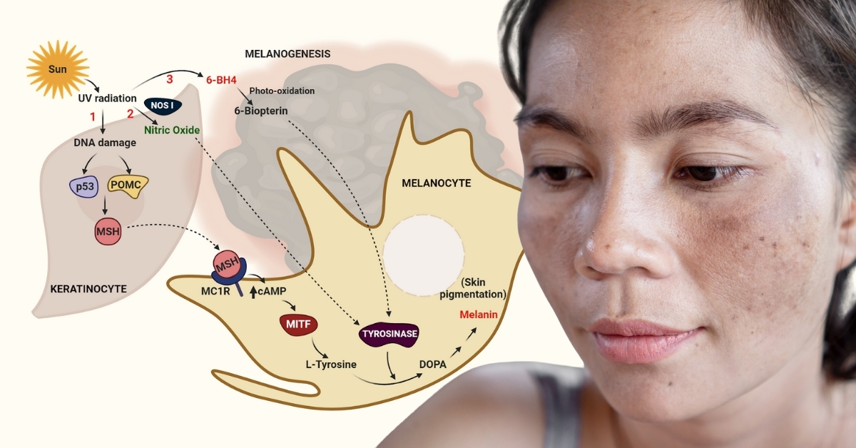 Nám và nguyên nhân dẫn đến nám