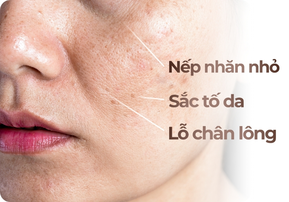 Trẻ hóa da toàn diện