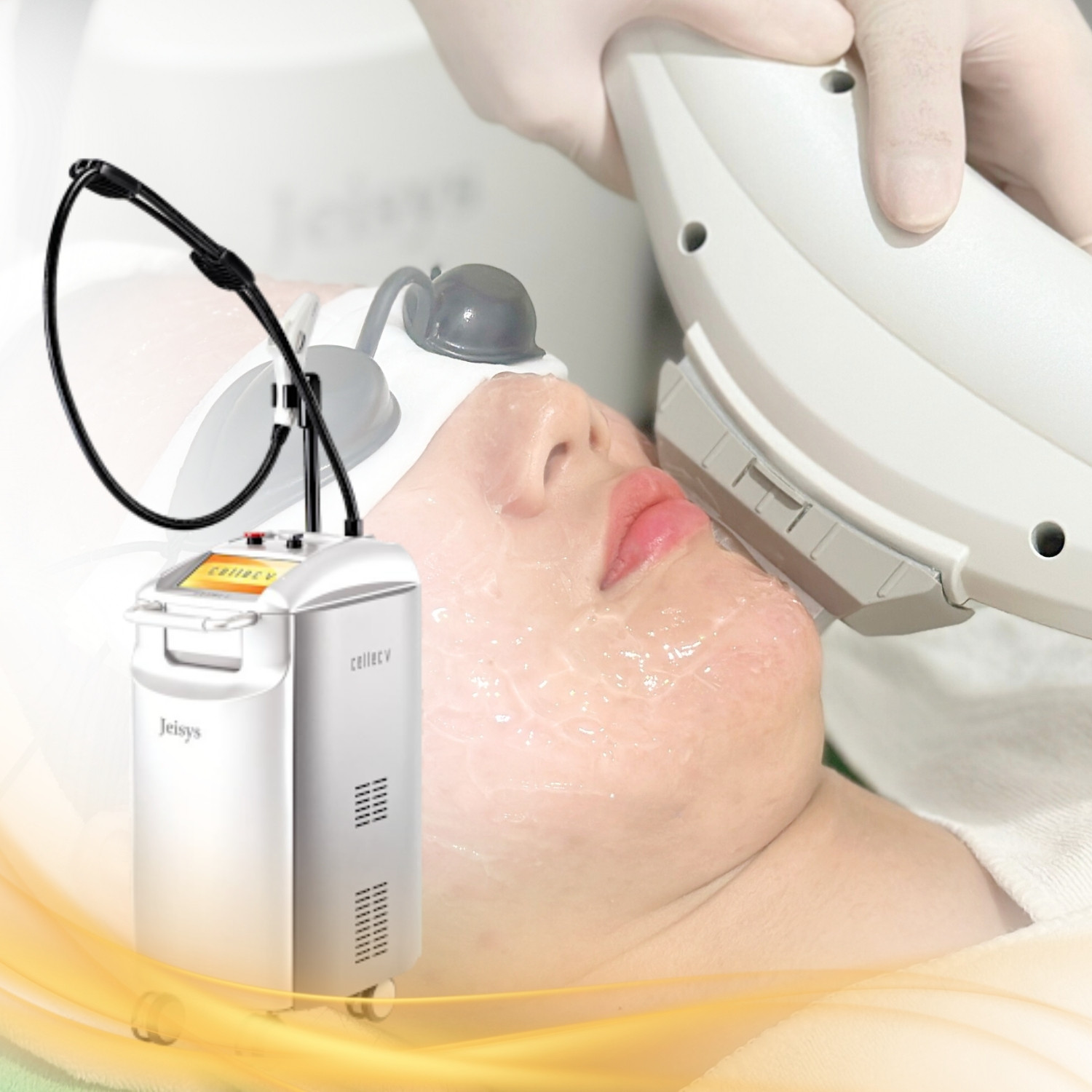 _Ánh sáng xung cường độ cao (IPL)