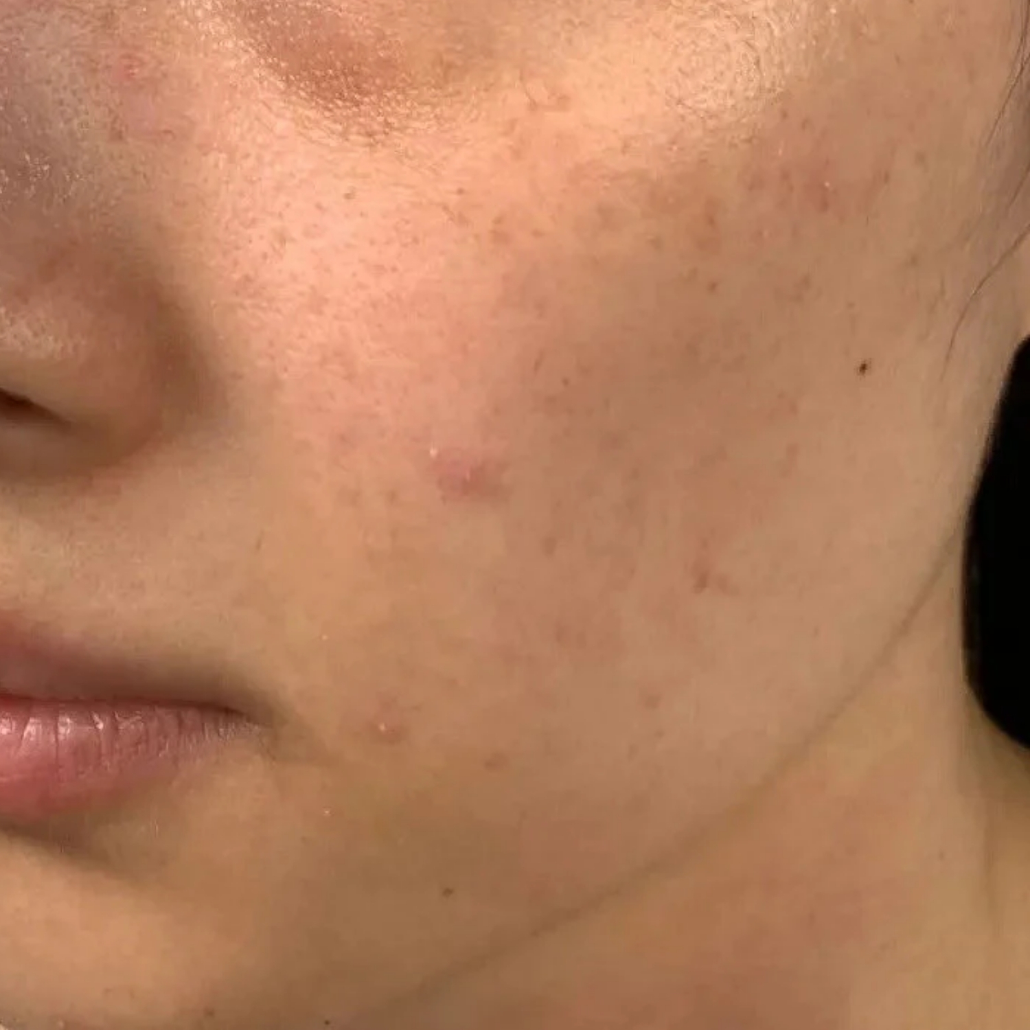 Da xỉn màu thiếu sức sống