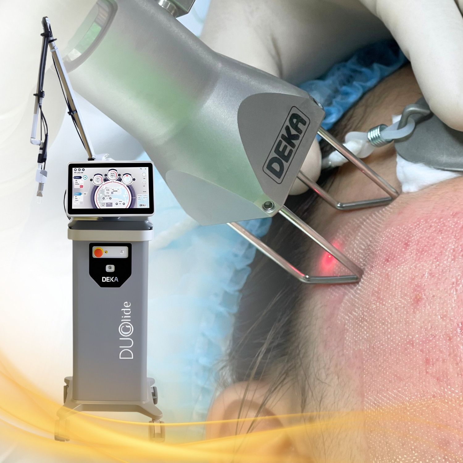 Laser fractional CO2 (cool peel)