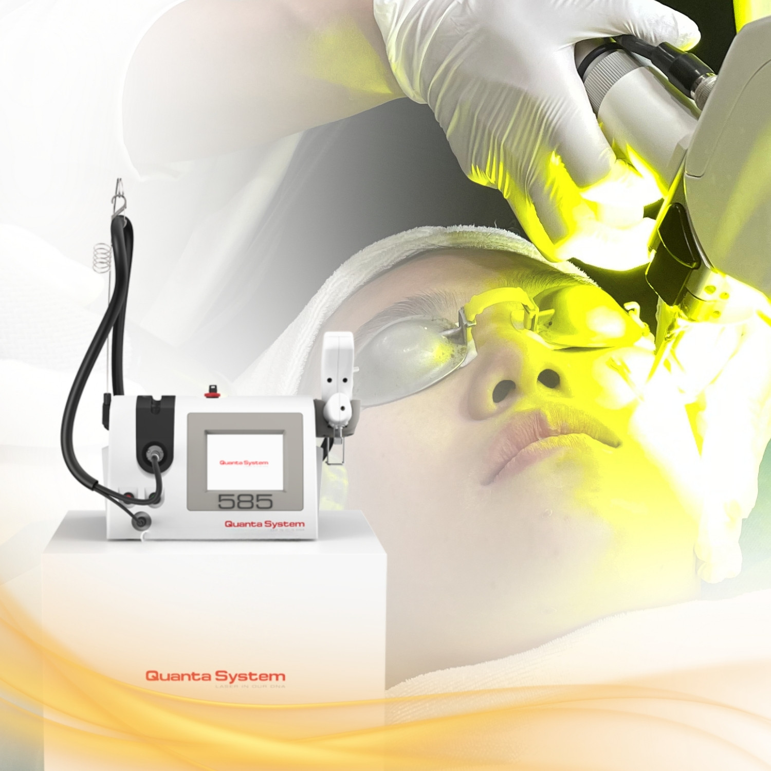 Laser nhuộm xung (PDL)