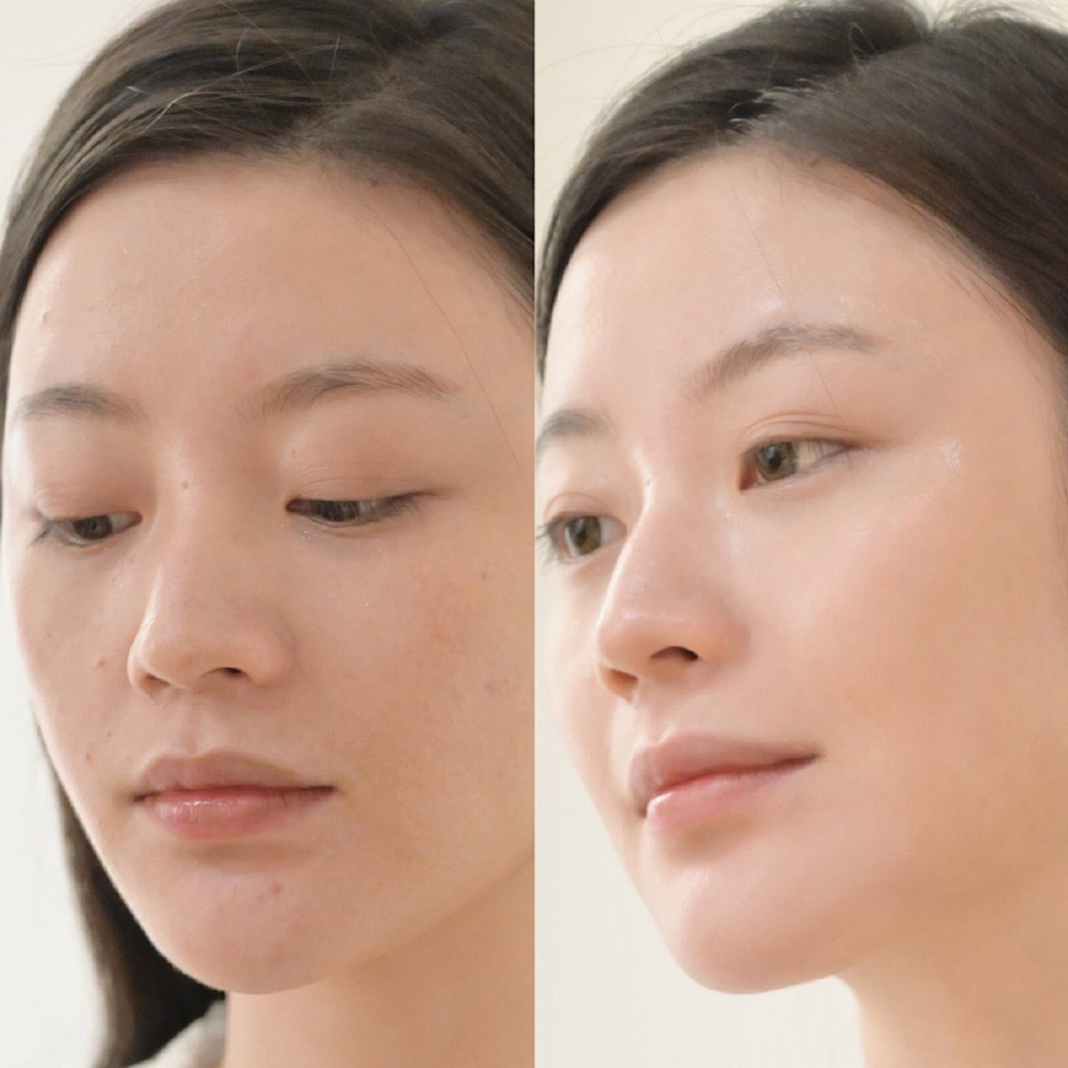 Người muốn ngăn ngừa lão hóa da sớm