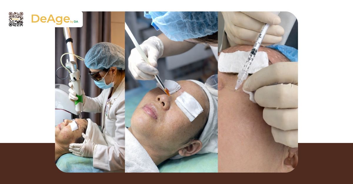 Da bị nám nhẹ có tự hết không? Hướng dẫn chăm sóc và trị đúng cách 4 liệu trình da nám nhẹ