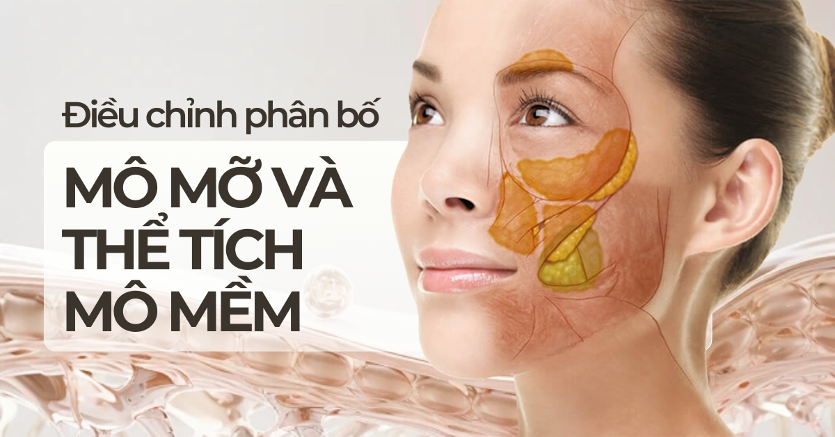 Điều chỉnh phân bố mô mỡ và thể tích mô mềm