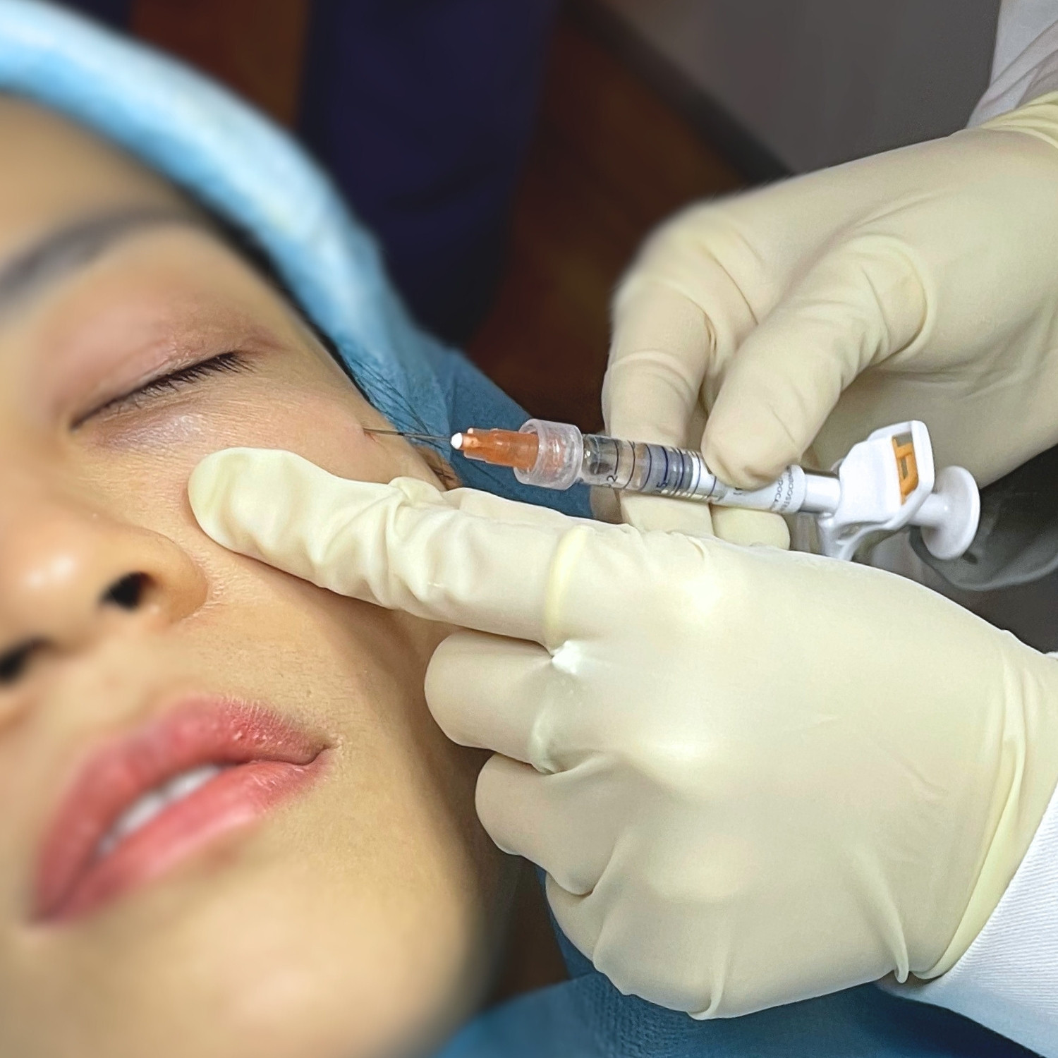 Kỹ thuật tiêm bằng cannula