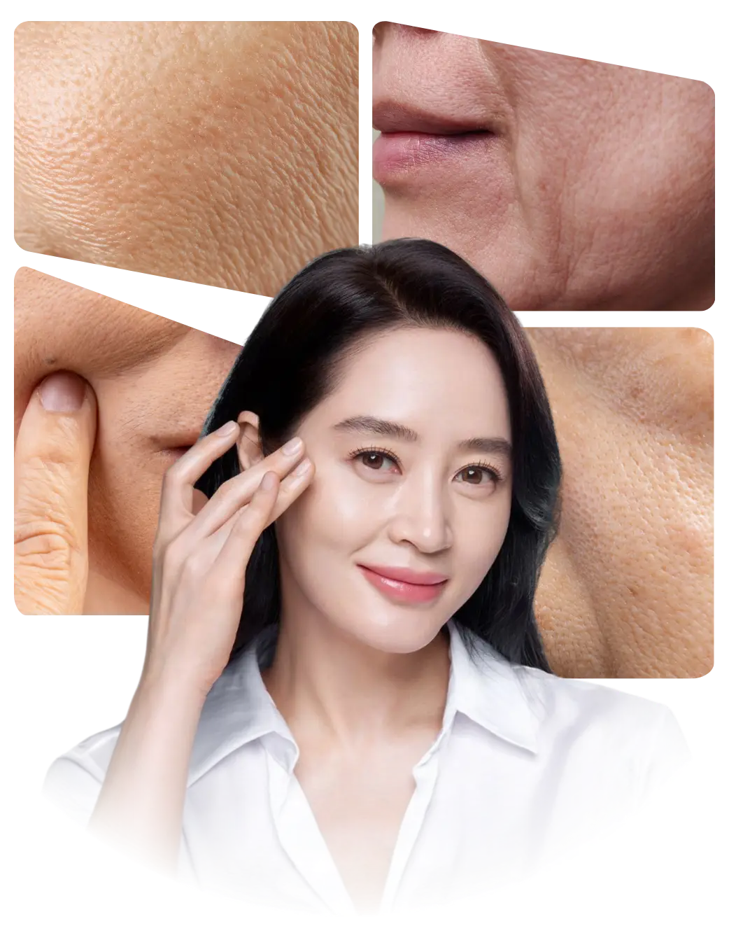 Nâng cơ trẻ hóa