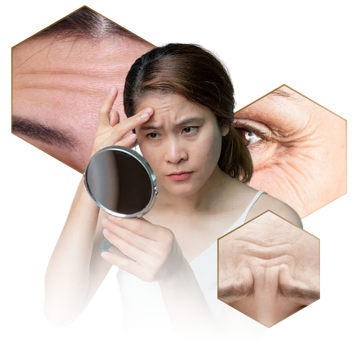Nếp nhăn động