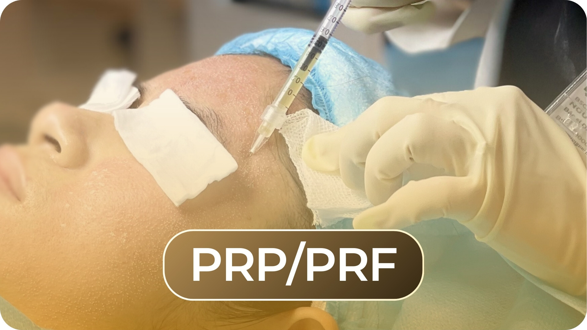 PRP_PRF