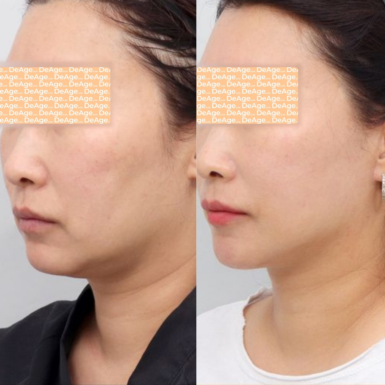 Phục hồi độ sắt nét của gương mặt