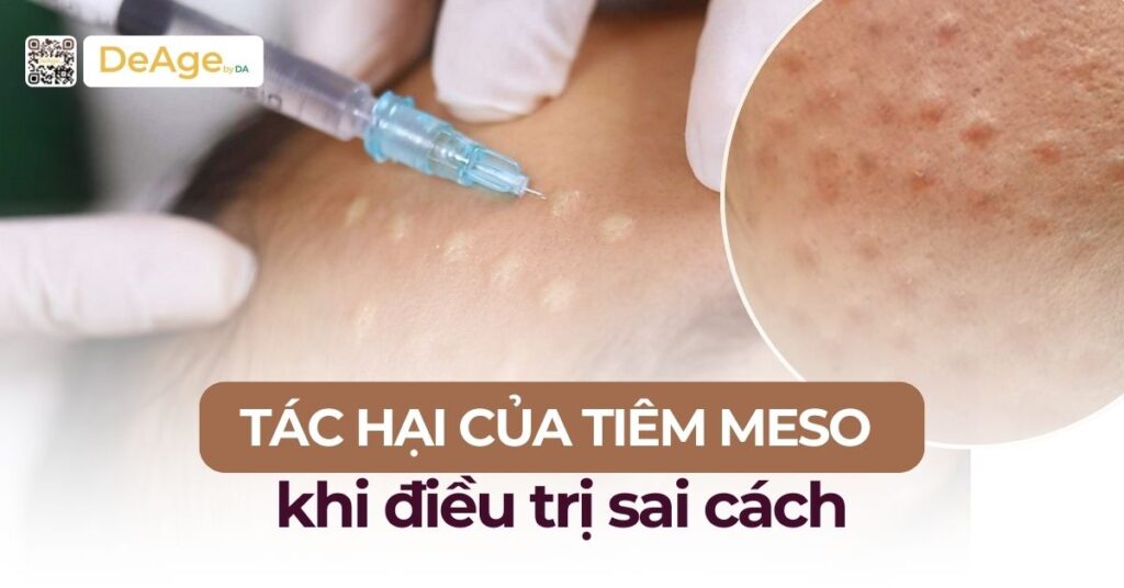 Tác hại của tiêm meso khi điều trị sai cách 7 Tác hại của tiêm meso