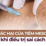 Tác hại của tiêm meso khi điều trị sai cách