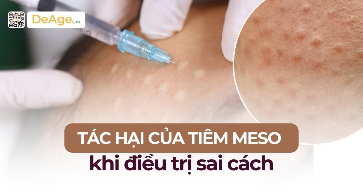 Tác hại của tiêm meso