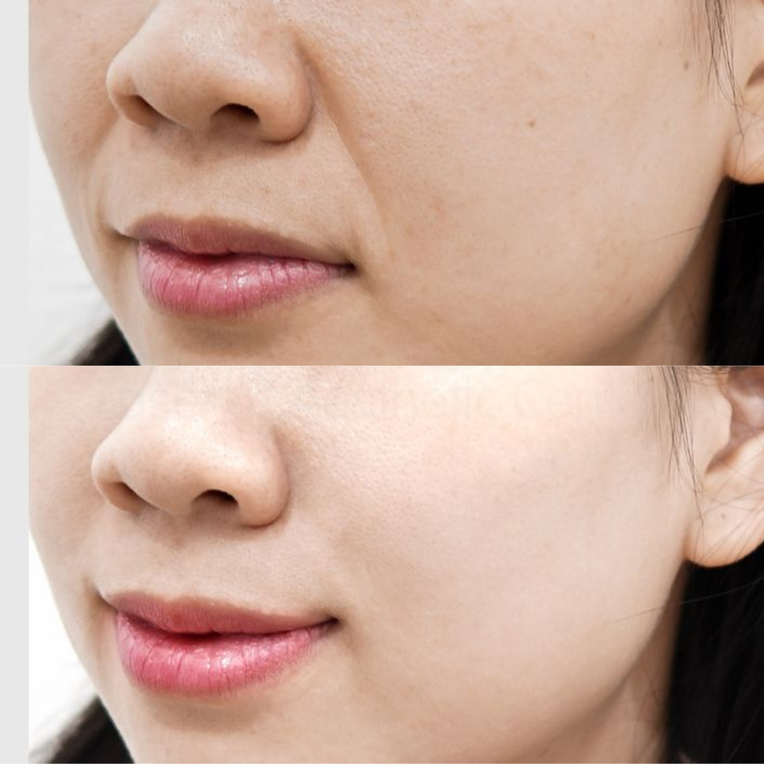 Tăng độ săn chắc và đàn hồi da
