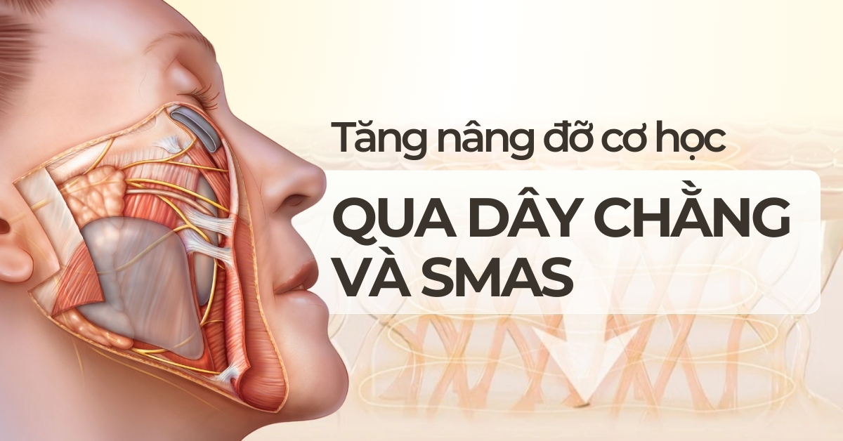 Tăng nâng đỡ cơ học qua dây chằng và smas