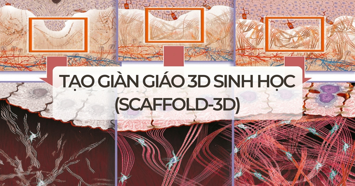 Tạo giàn giáo 3D sinh học (Scaffold-3D)