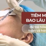 Nên tiêm meso bao lâu 1 lần để trẻ hóa da an toàn và hiệu quả?