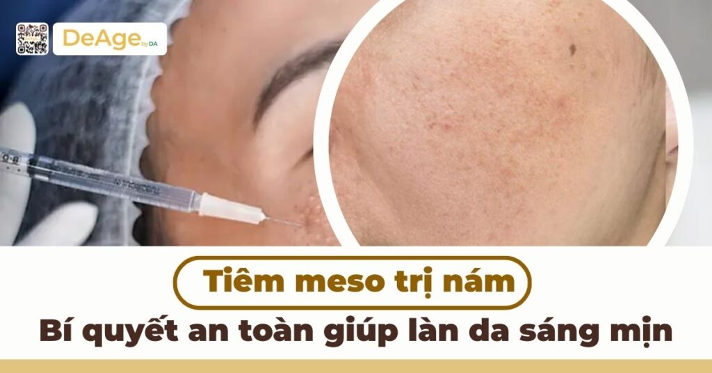 Tiêm meso trị nám: bí quyết an toàn giúp làn da sáng mịn 13 ảnh bìa tiêm meso trị nám