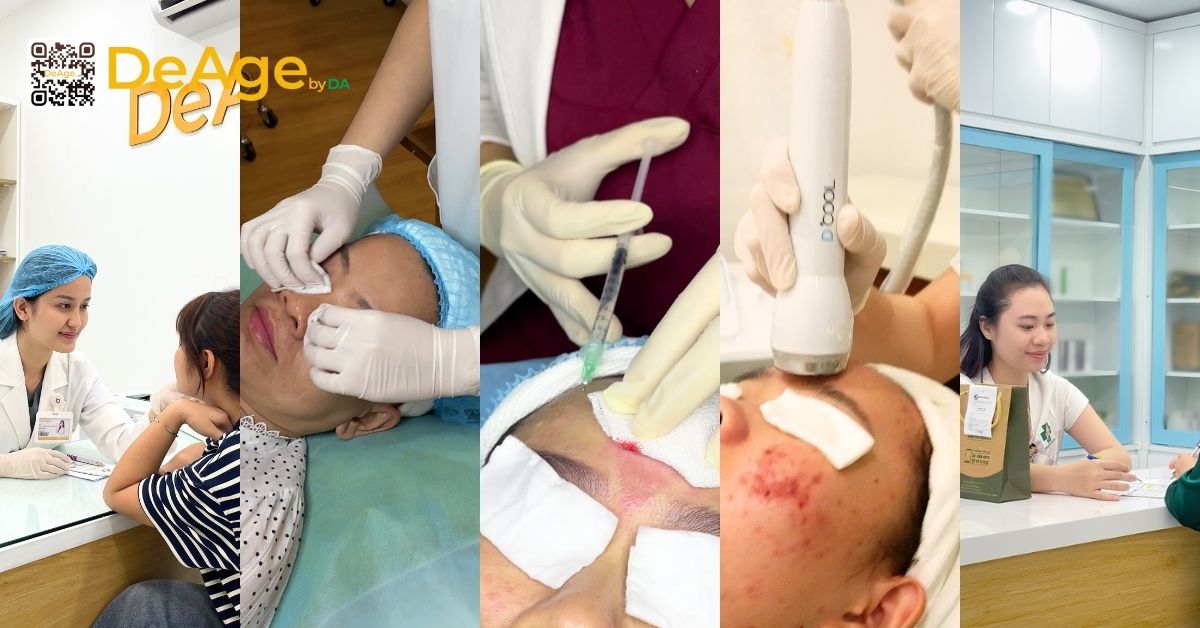 Tiêm meso giá bao nhiêu? Đừng vội quyết định chỉ dựa vào giá 6 các bước tiêm meso