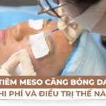 Tiêm meso căng bóng da: chi phí và hiệu quả thế nào?