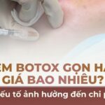Tiêm botox gọn hàm giá bao nhiêu? 4 yếu tố ảnh hưởng đến chi phí