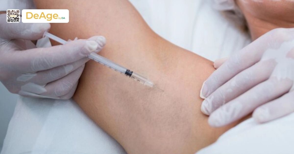 Tiêm botox trị hôi nách giá bao nhiêu? Ai phù hợp và nên thực hiện ở đâu? 3 tiêm botox tại nách