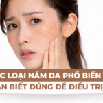 Các loại nám da phổ biến và cách nhận biết đúng để trị hiệu quả