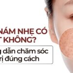 Da bị nám nhẹ có tự hết không? Hướng dẫn chăm sóc và trị đúng cách
