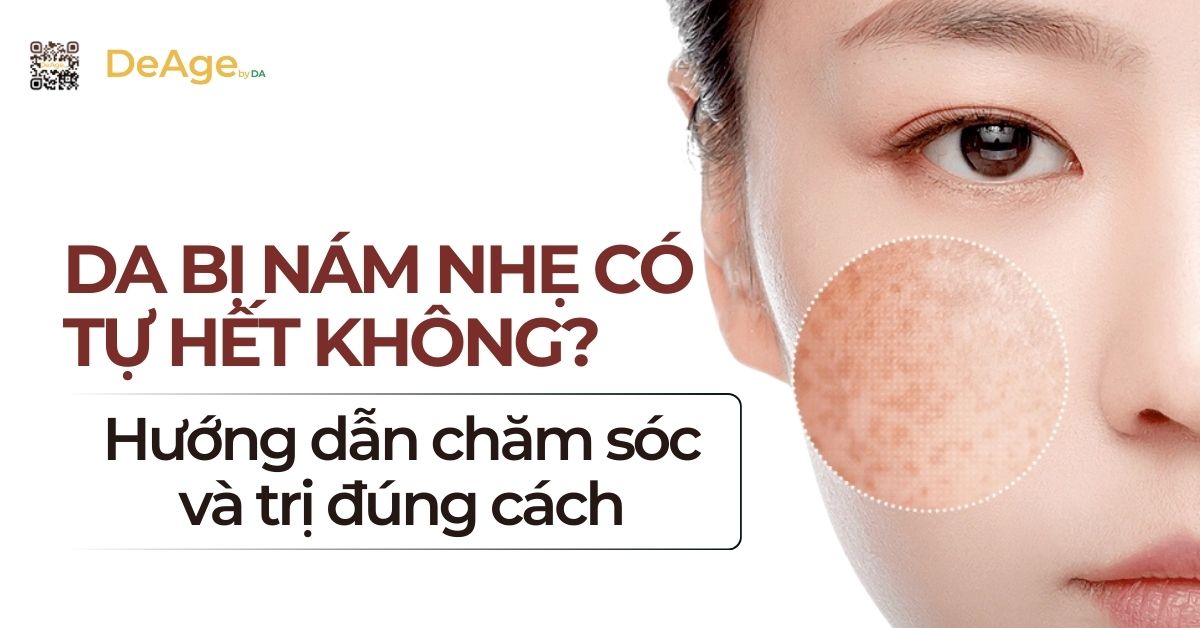 tiêu đề nám nhẹ có tự hết k