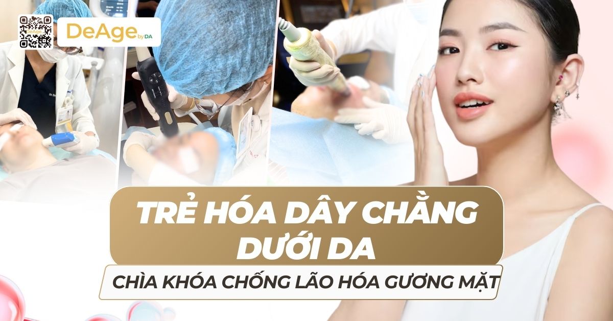 trẻ hóa dây chằng