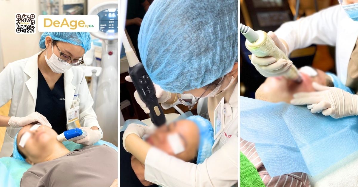 Trẻ hóa dây chằng dưới da: chìa khóa chống lão hóa gương mặt 4 một số pp công nghệ trẻ hóa da