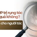 Tiêm PRP trị rụng tóc có hiệu quả không? Cứu cánh cho người tóc thưa, hói