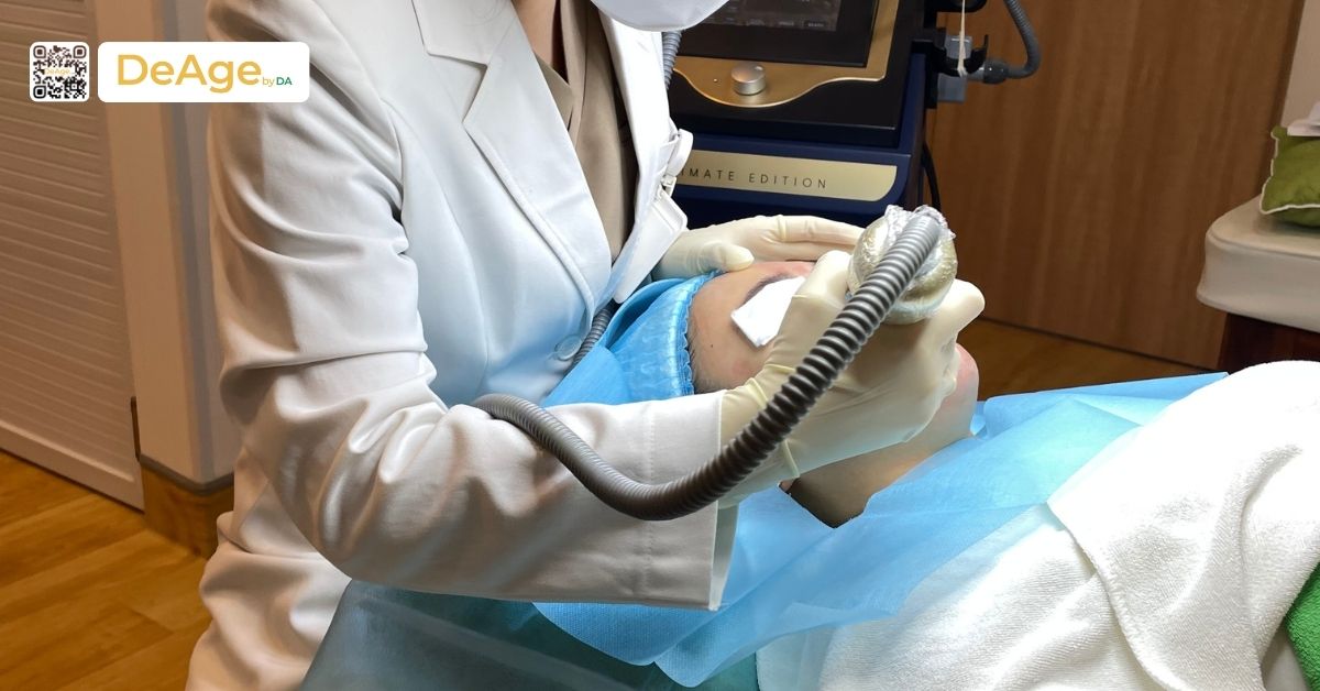 Vi kim RF Virtue là gì? So sánh với thiết bị Sylfirm X 1 bác sĩ làm liệu trình