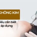 Meso không kim là gì? Những điều cần biết trước khi áp dụng
