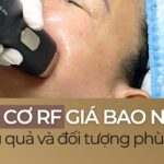 Nâng cơ RF giá bao nhiêu? Cần bao nhiêu lần để đạt hiệu quả?