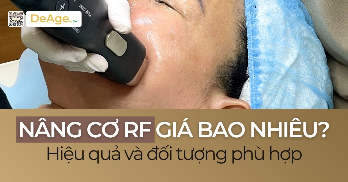 nâng cơ rf giá bao nhiu