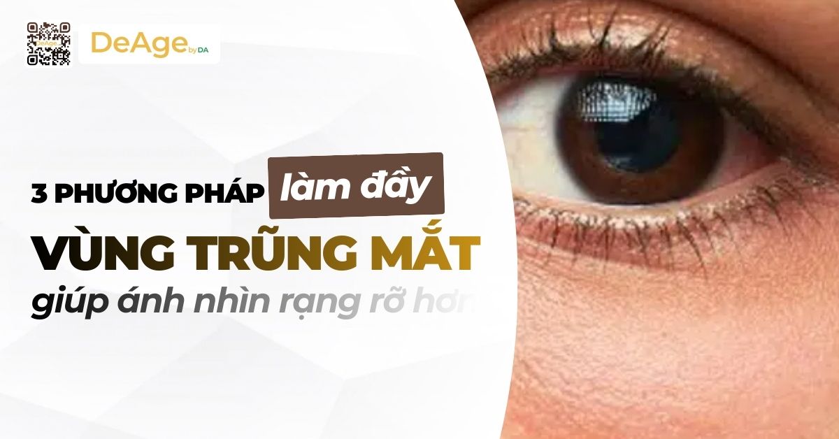 tiêu đề 3 Phương pháp làm đầy vũng trũng mắt