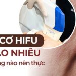 Nâng cơ HIFU giá bao nhiêu và đối tượng nào nên thực hiện?