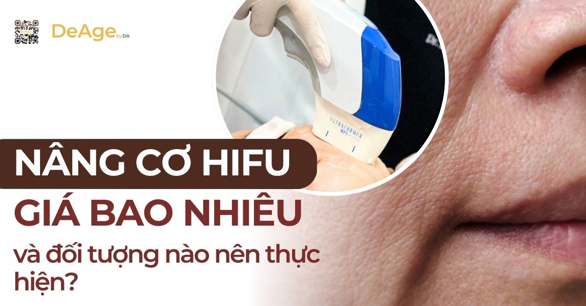 tiêu đề nâng cơ hifu giá bao nhiêu'