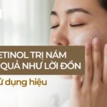 Dùng retinol trị nám có hiệu quả như lời đồn và cách sử dụng hiệu quả nhất