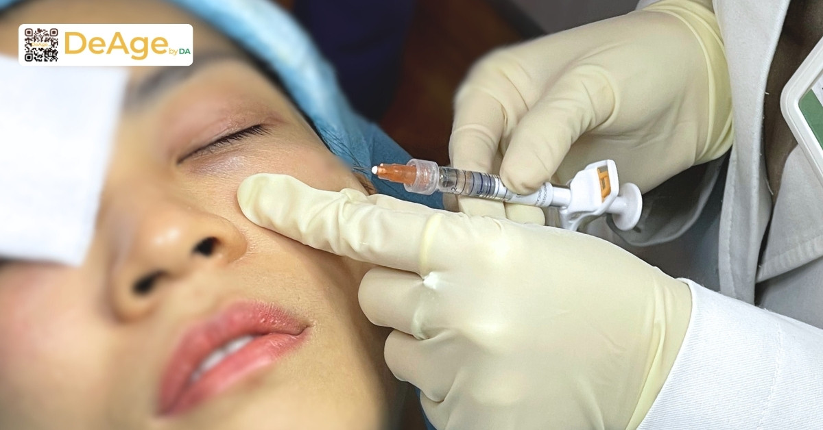 Top 10 phương pháp trẻ hóa vùng mắt hiệu quả hiện nay 11 không có hình tiêm mỡ tự thân - Thay hình tiêm làm đầy trũng mắt