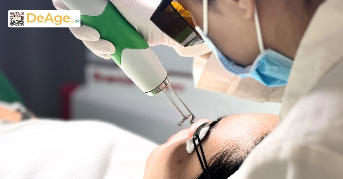 Top 10 phương pháp trẻ hóa vùng mắt hiệu quả hiện nay 6 Top 10 phương pháp trẻ hóa vùng mắt hiệu quả hiện nay 5