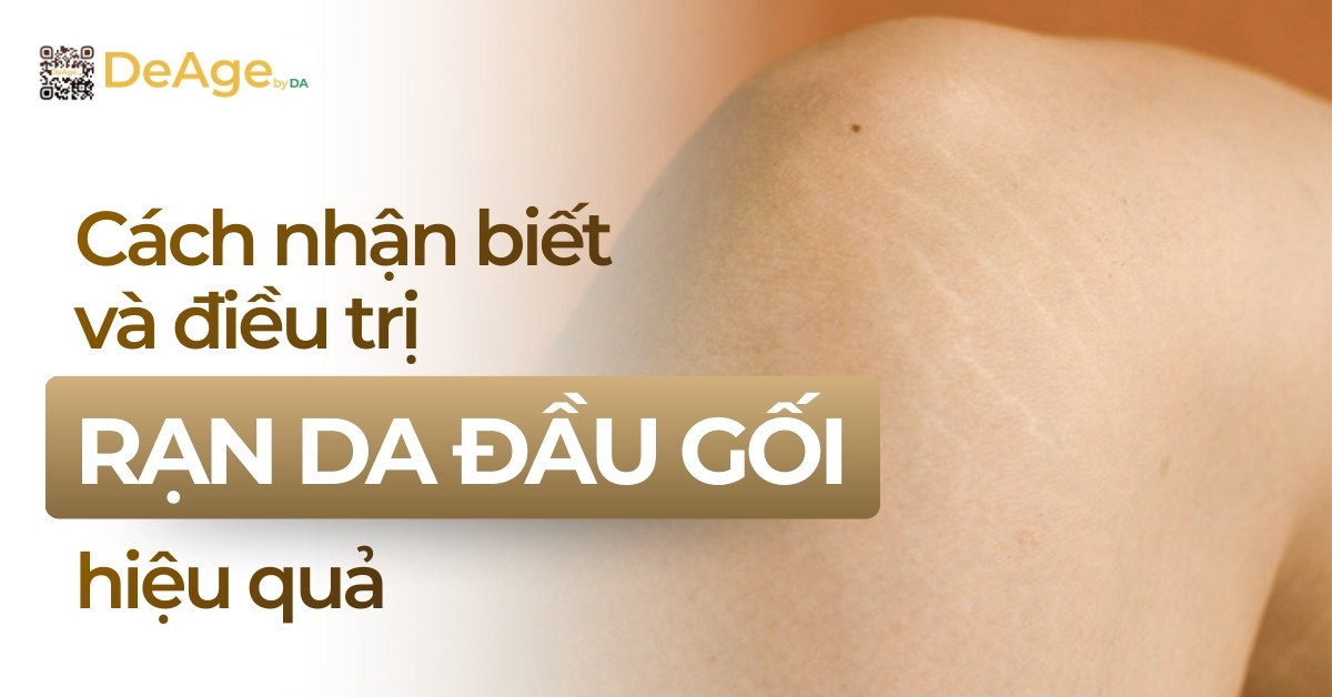 Thumb rạn da gối
