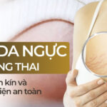 Rạn da ngực khi mang thai – nỗi lo thầm kín và cách cải thiện an toàn