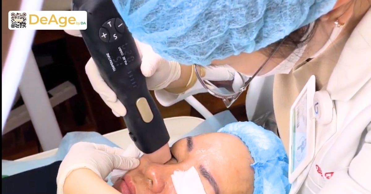 Nếp nhăn tĩnh: dấu hiệu nhận biết, nguyên nhân và giải pháp cải thiện 10 bs thực hiện density